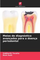 Meios de diagnóstico avançados para a doença periodontal (Portuguese Edition) 6203917737 Book Cover