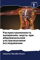 Распространенность ане&# 6205674394 Book Cover