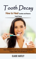 Tooth Decay: How to Heal Cavities and Reverse Tooth Decay 1998038165 Book Cover