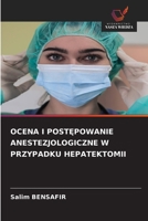 Ocena I PostEpowanie Anestezjologiczne W Przypadku Hepatektomii 6209215041 Book Cover