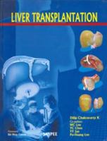 Liver Transplantation 8184487703 Book Cover