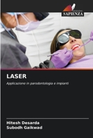 Laser (Italian Edition) 6208617251 Book Cover