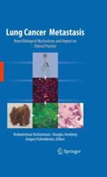Lung Cancer Metastasis: Novel Biological Mechanisms and Impact on Clinical Practice B0082PQN5Q Book Cover