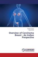 Overview of Carcinoma Breast - An Indian Prespective 3659334774 Book Cover
