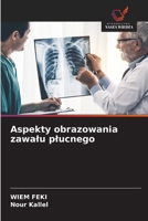 Aspekty obrazowania zawalu plucnego (Polish Edition) 6630049616 Book Cover