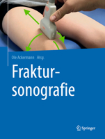 Fraktursonografie 3662585073 Book Cover