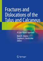 Fractures and Dislocations of the Talus and Calcaneus: A Case-Based Approach 3030373622 Book Cover