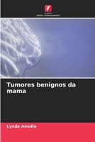 Tumores benignos da mama (Portuguese Edition) 6207945816 Book Cover