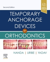 Temporary Anchorage Devices in Orthodontics 0323048072 Book Cover