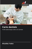 Carie dentale: Profilo batteriologico della carie dentale (Italian Edition) 6203909513 Book Cover