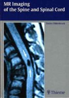 MR Imaging of the Spine and Spinal Cord 1588902641 Book Cover