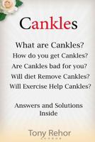 Cankles: This Guide will answer all of your Cankles questions 1482785811 Book Cover