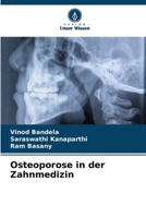 Osteoporose in der Zahnmedizin (German Edition) 6208054699 Book Cover