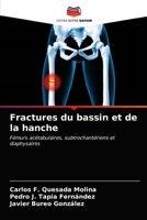 Fractures du bassin et de la hanche 6203641081 Book Cover
