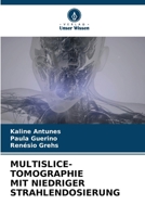 Multislice-Tomographie Mit Niedriger Strahlendosierung (German Edition) 6207516869 Book Cover