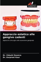 Approccio estetico alle gengive cadenti 6203678678 Book Cover