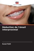 Réduction de l'émail interproximal 6205614324 Book Cover