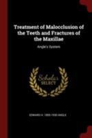 Treatment of Malocclusion of the Teeth and Fractures of the Maxillae: Angle's System 101555170X Book Cover