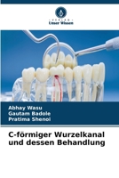 C-förmiger Wurzelkanal und dessen Behandlung (German Edition) 6630256557 Book Cover