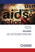 Hiv/AIDS 6203465054 Book Cover