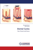 Dental Caries: Past, Present and Future 6200539715 Book Cover