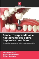 Conceitos aprendidos e não aprendidos sobre implantes dentários (Portuguese Edition) 6206947718 Book Cover