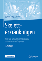 Skeletterkrankungen: Klinisch-Radiologische Diagnose Und Differentialdiagnose 3662481367 Book Cover