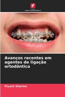 Avanços recentes em agentes de ligação ortodôntica (Portuguese Edition) 6209399975 Book Cover