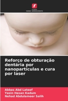Reforço de obturação dentária por nanopartículas e cura por laser (Portuguese Edition) B0CK3XGBWS Book Cover