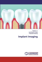 Implant Imaging 6200095698 Book Cover