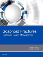 Scaphoid Fractures: Evidence-Based Management 0323485642 Book Cover