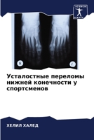 Усталостные переломы ни& 6205619792 Book Cover
