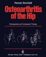 Osteoarthritis of the Hip: Pathogenesis and Consequent Therapy 3540078428 Book Cover