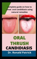 ORAL THRUSH CANDIDIASIS: Complete Guide on How to Treat Oral Candidiasis Using Natural Remedies B09FC8CLZL Book Cover