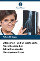 Ultraschall- und CT-gesteuerte Nierenbiopsie bei Erkrankungen des Nierenparenchyms (German Edition) 6209995705 Book Cover