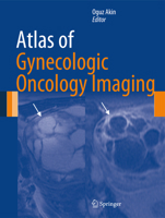 Atlas of Gynecologic Oncology Imaging 1461472113 Book Cover