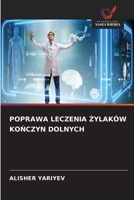 Poprawa Leczenia Zylaków KoNczyn Dolnych (Polish Edition) 6209989896 Book Cover
