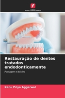 Restauração de dentes tratados endodonticamente: Postagem e Núcleo (Portuguese Edition) B0CL5RWJML Book Cover