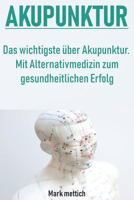 Akupunktur: Das wichtigste �ber Akupunktur - Mit Alternativmedizin zum gesundheitlichen Erfolg 1728812054 Book Cover