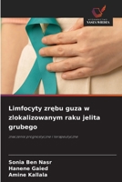 Limfocyty zrebu guza w zlokalizowanym raku jelita grubego (Polish Edition) 6630583310 Book Cover
