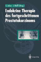 Endokrine Therapie Des Fortgeschrittenen Prostatakarzinoms 3642768679 Book Cover