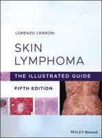 Skin Lymphoma: The Illustrated Guide 1119485908 Book Cover