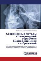 Sovremennye metody komp'yuternoy obrabotki biomeditsinskikh izobrazheniy: Obzor sovremennykh metodov polucheniya i obrabotki biomeditsinskikh izobrazheniy 365926430X Book Cover