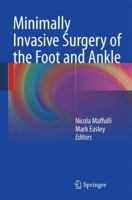 Minimally Invasive Surgery of the Foot and Ankle 1849964165 Book Cover