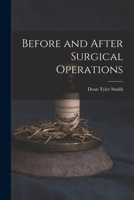 Before and After Surgical Operations 1018922377 Book Cover