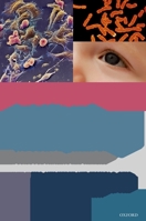 Aniridia and WAGR Syndrome: A Guide for Patients and Families [With CDROM] 0195389301 Book Cover