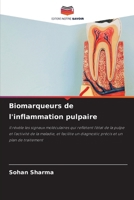 Biomarqueurs de l'inflammation pulpaire 6209643752 Book Cover