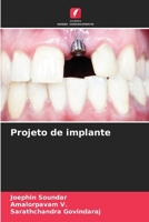 Projeto de implante 6206974375 Book Cover