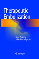 Therapeutic Embolization 3319424920 Book Cover