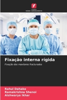 Fixação interna rígida: Fixação dos maxilares fracturados (Portuguese Edition) 6208670896 Book Cover